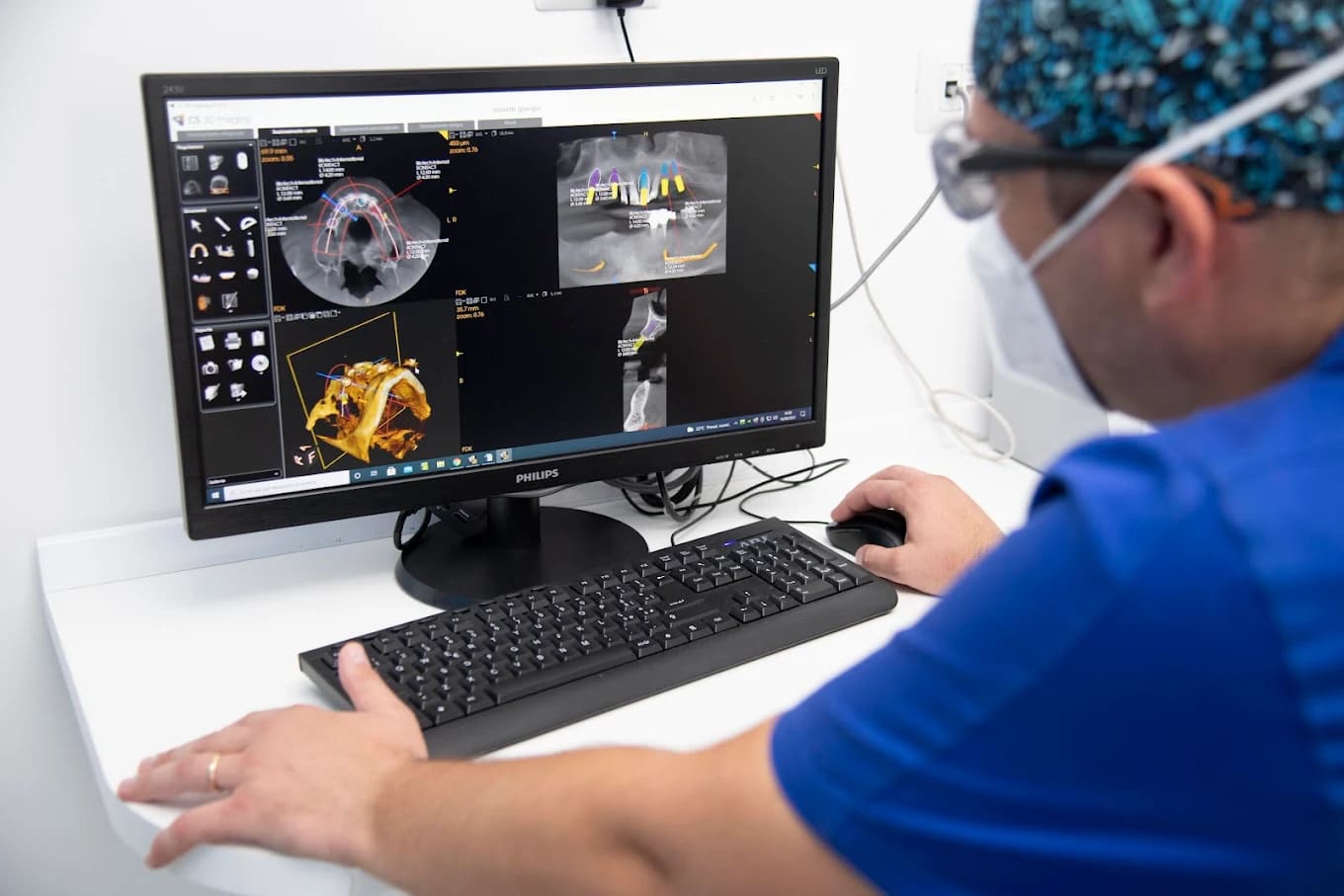 La misurazione elettromiografica prima della riabilitazione: sensori sul viso e tracciato sul monitor.